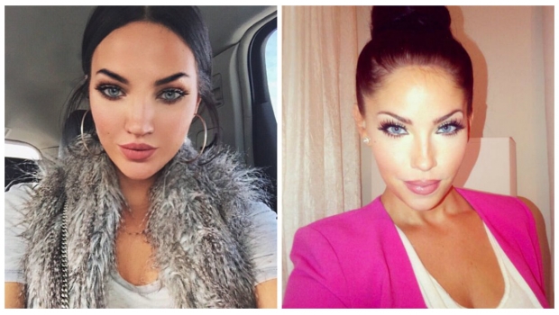 #Sorprendente: Novias de grandes atletas se someten a blanqueamiento anal en reality show